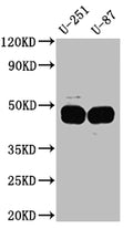 Western Blot
Positive WB detected in: U-251 whole cell lysate, U-87 whole cell lysate
All lanes: PAI1 Antibody at 1:1000
Secondary
Goat polyclonal to rabbit IgG at 1/50000 dilution
Predicted band size: 46, 44 kDa
Observed band size: 45 kDa