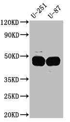 Western Blot
Positive WB detected in: U-251 whole cell lysate, U-87 whole cell lysate
All lanes: PAI1 Antibody at 1:1000
Secondary
Goat polyclonal to rabbit IgG at 1/50000 dilution
Predicted band size: 46, 44 kDa
Observed band size: 45 kDa