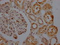 IHC image of CSB-RA156557A0HU diluted at 1:100 and staining in paraffin-embedded human kidney tissue performed on a Leica BondTM system. After dewaxing and hydration, antigen retrieval was mediated by high pressure in a citrate buffer (pH 6.0) . Section was blocked with 10% normal goat serum 30min at RT. Then primary antibody (1% BSA) was incubated at 4℃ overnight. The primary is detected by a Goat anti-rabbit IgG polymer labeled by HRP and visualized using 0.05% DAB.