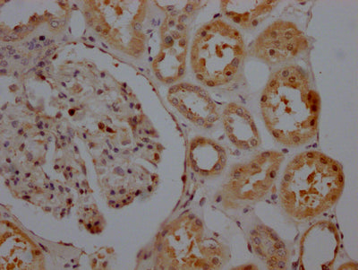 IHC image of CSB-RA156557A0HU diluted at 1:100 and staining in paraffin-embedded human kidney tissue performed on a Leica BondTM system. After dewaxing and hydration, antigen retrieval was mediated by high pressure in a citrate buffer (pH 6.0) . Section was blocked with 10% normal goat serum 30min at RT. Then primary antibody (1% BSA) was incubated at 4℃ overnight. The primary is detected by a Goat anti-rabbit IgG polymer labeled by HRP and visualized using 0.05% DAB.