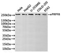 Western Blot
Positive WB detected in: Hela whole cell lysate(30µg), HepG2 whole cell lysate(30µg), U-251MG whole cell lysate(30µg), COLO-205 whole cell lysate(30µg), K562 whole cell lysate(30µg)
All lanes: PRPF8 antibody at 1:1000
Secondary
Goat polyclonal to rabbit IgG at 1/40000 dilution
Predicted band size: 274 kDa
Observed band size: 274 kDa
Exposure time：1min