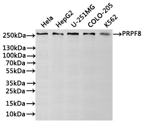 Western Blot
Positive WB detected in: Hela whole cell lysate(30µg), HepG2 whole cell lysate(30µg), U-251MG whole cell lysate(30µg), COLO-205 whole cell lysate(30µg), K562 whole cell lysate(30µg)
All lanes: PRPF8 antibody at 1:1000
Secondary
Goat polyclonal to rabbit IgG at 1/40000 dilution
Predicted band size: 274 kDa
Observed band size: 274 kDa
Exposure time：1min