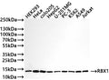 Western Blot
Positive WB detected in: HEK293 whole cell lysate, HeLa whole cell lysate(30µg) , COLO205 whole cell lysate(30µg) , HepG2 whole cell lysate, U-251MG whole cell lysate(30µg) , PC-3 whole cell lysate, K562 whole cell lysate(30µg) , A549 whole cell lysate, Jurkat whole cell lysate(30µg) 
All lanes: RBX1 antibody at 1:1000
Secondary
Goat polyclonal to rabbit IgG at 1/50000 dilution
Predicted band size: 12 kDa
Observed band size: 12 kDa
Exposure time: 30s