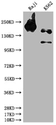 INPP5D Antibody – Figure 1 of 3