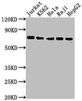 Western Blot
Positive WB detected in: Jurkat whole cell lysate, K562 whole cell lysate, Hela whole cell lysate, Raji whole cell lysate, HepG2 whole cell lysate
All lanes: FUBP1 antibody at 1:2000
Secondary
Goat polyclonal to rabbit IgG at 1/50000 dilution
Predicted band size: 68, 69 kDa
Observed band size: 69 kDa