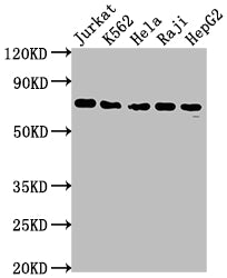 Western Blot
Positive WB detected in: Jurkat whole cell lysate, K562 whole cell lysate, Hela whole cell lysate, Raji whole cell lysate, HepG2 whole cell lysate
All lanes: FUBP1 antibody at 1:2000
Secondary
Goat polyclonal to rabbit IgG at 1/50000 dilution
Predicted band size: 68, 69 kDa
Observed band size: 69 kDa