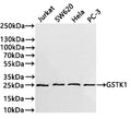 Western Blot
Positive WB detected in: Jurkat whole cell lysate(30µg) ,SW620 whole cell lysate(30µg) , Hela whole cell lysate(30µg) , PC-3 whole cell lysate(30µg) 
All lanes: GSTK1 antibody at 1:1000
Secondary
Goat polyclonal to rabbit IgG at 1/40000 dilution
Predicted band size: 25 kDa
Observed band size: 25 kDa
Exposure time：3min