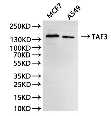 Western Blot
Positive WB detected in: MCF-7 whole cell lysate(30µg), A549 whole cell lysate(30µg)
All lanes: TAF3 antibody at 1:1000
Secondary
Goat polyclonal to rabbit IgG at 1/40000 dilution
Predicted band size: 104 kDa
Observed band size: 150 kDa
Exposure time：5min