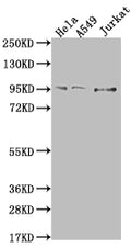 Western Blot
Positive WB detected in: Hela whole cell lysate, A549 whole cell lysate, Jurkat whole cell lysate
All lanes: CARS antibody at 1:500
Secondary
Goat polyclonal to rabbit IgG at 1/50000 dilution
Predicted band size: 86, 83, 95 kDa
Observed band size: 95 kDa