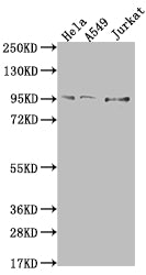 Western Blot
Positive WB detected in: Hela whole cell lysate, A549 whole cell lysate, Jurkat whole cell lysate
All lanes: CARS antibody at 1:500
Secondary
Goat polyclonal to rabbit IgG at 1/50000 dilution
Predicted band size: 86, 83, 95 kDa
Observed band size: 95 kDa