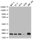 Western Blot
Positive WB detected in: MCF-7 whole cell lysate, PC3 whole cell lysate, Hela whole cell lysate, A549 whole cell lysate, HEK293 whole cell lysate
All lanes: MRAS antibody at 1:1000
Secondary
Goat polyclonal to rabbit IgG at 1/50000 dilution
Predicted band size: 24, 16 kDa
Observed band size: 24 kDa