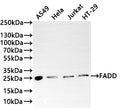 Western Blot
Positive WB detected in: A549 whole cell lysate(20µg) ,Hela whole cell lysate(20µg) , Jurkat whole cell lysate(20µg) ,NIH/3T3 whole cell lysate(20µg) 
All lanes: FADD antibody at 1:1000
Secondary
Goat polyclonal to rabbit IgG at 1/40000 dilution
Predicted band size: 23 kDa
Observed band size: 25 kDa
Exposure time：2min