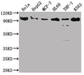 SUZ12 Antibody – Figure 1 of 3