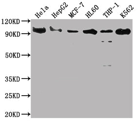 SUZ12 Antibody – Figure 1 of 3