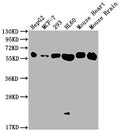 Western Blot
Positive WB detected in: HepG2 whole cell lysate, MCF-7 whole cell lysate, 293 whole cell lysate, HL60 whole cell lysate, Mouse Heart tissue, Mouse Brain tissue
All lanes: ATP5F1A antibody at 1:2000
Secondary
Goat polyclonal to rabbit IgG at 1/50000 dilution
Predicted band size: 60, 55, 58 kDa
Observed band size: 60 kDa