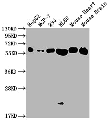 Western Blot
Positive WB detected in: HepG2 whole cell lysate, MCF-7 whole cell lysate, 293 whole cell lysate, HL60 whole cell lysate, Mouse Heart tissue, Mouse Brain tissue
All lanes: ATP5F1A antibody at 1:2000
Secondary
Goat polyclonal to rabbit IgG at 1/50000 dilution
Predicted band size: 60, 55, 58 kDa
Observed band size: 60 kDa