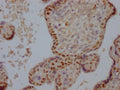 IHC image of CSB-RA160202A0HU diluted at 1:100 and staining in paraffin-embedded human placenta tissue performed on a Leica BondTM system. After dewaxing and hydration, antigen retrieval was mediated by high pressure in a citrate buffer (pH 6.0) . Section was blocked with 10% normal goat serum 30min at RT. Then primary antibody (1% BSA) was incubated at 4℃ overnight. The primary is detected by a Goat anti-rabbit IgG polymer labeled by HRP and visualized using 0.05% DAB.