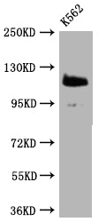Western Blot
Positive WB detected in: K562 whole cell lysate
All lanes: PARP antibody at 1:2000
Secondary
Goat polyclonal to rabbit IgG at 1/50000 dilution
Predicted band size: 114 kDa
Observed band size: 114 kDa