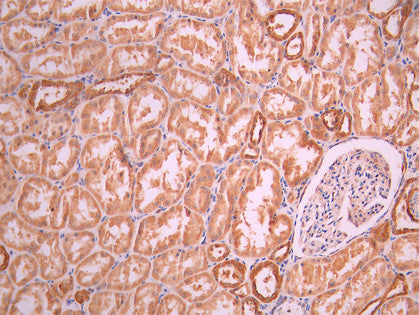 IHC image of CSB-RA161234A0HU diluted at 1:100 and staining in paraffin-embedded human kidney tissue performed on a Leica BondTM system. After dewaxing and hydration, antigen retrieval was mediated by high pressure in a citrate buffer (pH 6.0). Section was blocked with 10% normal goat serum 30min at RT. Then primary antibody (1% BSA) was incubated at 4°C overnight. The primary is detected by a Goat anti-rabbit polymer IgG labeled by HRP and visualized using 0.05% DAB.