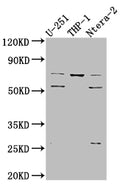 PTH1R Antibody – Figure 1 of 1