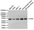 Western Blot
Positive WB detected in: NIH/3T3 whole cell lysate(30µg), A549 whole cell lysate(30µg), MCF-7 whole cell lysate(30µg), Mouse brain tissuelysate(30µg), Rat brain tissuelysate(30µg)
All lanes: PPID antibody at 1:1000
Secondary
Goat polyclonal to rabbit IgG at 1/40000 dilution
Predicted band size: 41 kDa
Observed band size: 41 kDa
Exposure time：2min