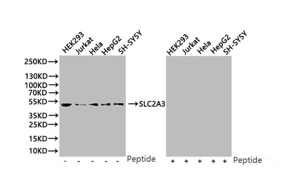 SLC2A3 Antibody – Figure 1 of 5
