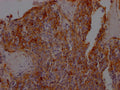 IHC image of CSB-RA162789A0HU diluted at 1:100 and staining in paraffin-embedded human tonsil tissue performed on a Leica BondTM system. After dewaxing and hydration, antigen retrieval was mediated by high pressure in a citrate buffer (pH 6.0) . Section was blocked with 10% normal goat serum 30min at RT. Then primary antibody (1% BSA) was incubated at 4℃ overnight. The primary is detected by a Goat anti-rabbit IgG polymer labeled by HRP and visualized using 0.05% DAB.