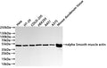 Western Blot
Positive WB detected in:  Hela whole cell lysate(30µg) , HT-29 whole cell lysate(30µg) , COLO-205 whole cell lysate(30µg) , HEK293 whole cell lysate(30µg) , A431 whole cell lysate(30µg) , A375 whole cell lysate(30µg) , Mouse duodenum tissue lysate(30µg) 
All lanes:alpha Smooth muscle actin antibody at 1:1000
Secondary
Goat polyclonal to rabbit IgG at 1/40000 dilution
Predicted band size: 42 kDa
Observed band size: 45 kDa
Exposure time：20s