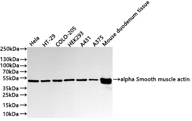Western Blot
Positive WB detected in:  Hela whole cell lysate(30µg) , HT-29 whole cell lysate(30µg) , COLO-205 whole cell lysate(30µg) , HEK293 whole cell lysate(30µg) , A431 whole cell lysate(30µg) , A375 whole cell lysate(30µg) , Mouse duodenum tissue lysate(30µg) 
All lanes:alpha Smooth muscle actin antibody at 1:1000
Secondary
Goat polyclonal to rabbit IgG at 1/40000 dilution
Predicted band size: 42 kDa
Observed band size: 45 kDa
Exposure time：20s