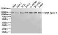 Western Blot
Positive WB detected in: Hela whole cell lysate(30µg), MCF-7 whole cell lysate(30µg), A431 whole cell lysate(30µg), THP-1 whole cell lysate(30µg), U-251MG whole cell lysate(30µg), SH-SY5Y whole cell lysate(30µg), Jurkat whole cell lysate(30µg)
All lanes: DNA ligase 4 antibody at 1:1000
Secondary
Goat polyclonal to rabbit IgG at 1/40000 dilution
Predicted band size: 104 kDa
Observed band size: 104 kDa
Exposure time：1min