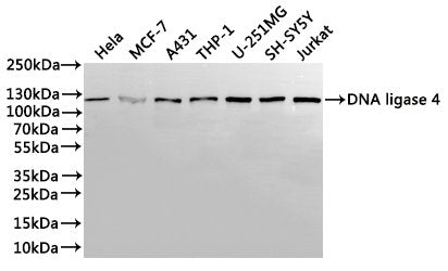 Western Blot
Positive WB detected in: Hela whole cell lysate(30µg), MCF-7 whole cell lysate(30µg), A431 whole cell lysate(30µg), THP-1 whole cell lysate(30µg), U-251MG whole cell lysate(30µg), SH-SY5Y whole cell lysate(30µg), Jurkat whole cell lysate(30µg)
All lanes: DNA ligase 4 antibody at 1:1000
Secondary
Goat polyclonal to rabbit IgG at 1/40000 dilution
Predicted band size: 104 kDa
Observed band size: 104 kDa
Exposure time：1min