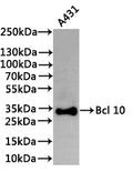 Western Blot
Positive WB detected in: A431 whole cell lysate(30µg)
All lanes: Bcl 10 antibody at 1:1000
Secondary
Goat polyclonal to rabbit IgG at 1/40000 dilution
Predicted band size: 26 kDa
Observed band size: 31 kDa
Exposure time：5min