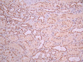 IHC image of CSB-RA164774A0HU diluted at 1:100 and staining in paraffin-embedded human kidney tissue performed on a Leica BondTM system. After dewaxing and hydration, antigen retrieval was mediated by high pressure in a citrate buffer (pH 6.0). Section was blocked with 10% normal goat serum 30min at RT. Then primary antibody (1% BSA) was incubated at 4°C overnight. The primary is detected by a Goat anti-rabbit polymer IgG labeled by HRP and visualized using 0.05% DAB.