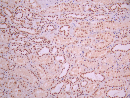 IHC image of CSB-RA164774A0HU diluted at 1:100 and staining in paraffin-embedded human kidney tissue performed on a Leica BondTM system. After dewaxing and hydration, antigen retrieval was mediated by high pressure in a citrate buffer (pH 6.0). Section was blocked with 10% normal goat serum 30min at RT. Then primary antibody (1% BSA) was incubated at 4°C overnight. The primary is detected by a Goat anti-rabbit polymer IgG labeled by HRP and visualized using 0.05% DAB.