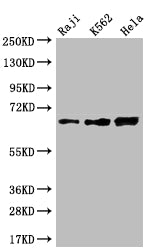 Western Blot
Positive WB detected in: Raji whole cell lysate, K562 whole cell lysate, Hela whole cell lysate
All lanes: CD58 antibody at 1:2000
Secondary
Goat polyclonal to rabbit IgG at 1/50000 dilution
Predicted band size: 29, 27, 26 kDa
Observed band size: 55-70 kDa