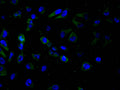 Immunofluorescence staining of MCF-7 cell with CSB-RA166610A0HU at 1:50, counter-stained with DAPI. The cells were fixed in 4% formaldehyde and blocked in 10% normal Goat Serum. The cells were then incubated with the antibody overnight at 4°C. The secondary antibody was Alexa Fluor 488-congugated AffiniPure Goat Anti-Rabbit IgG(H+L) .