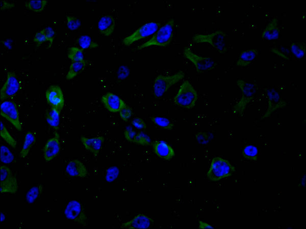 Immunofluorescence staining of MCF-7 cell with CSB-RA166610A0HU at 1:50, counter-stained with DAPI. The cells were fixed in 4% formaldehyde and blocked in 10% normal Goat Serum. The cells were then incubated with the antibody overnight at 4°C. The secondary antibody was Alexa Fluor 488-congugated AffiniPure Goat Anti-Rabbit IgG(H+L) .