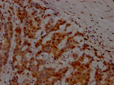 ATM Antibody – Figure 1 of 3