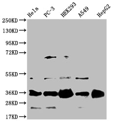 Western Blot
Positive WB detected in: Hela whole cell lysate, PC-3 whole cell lysate, HEK293 whole cell lysate, A549 whole cell lysate, HepG2 whole cell lysate
All lanes: HMGCL antibody at 1:1000
Secondary
Goat polyclonal to rabbit IgG at 1/50000 dilution
Predicted band size: 35, 27, 21 kDa
Observed band size: 35 kDa