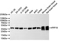 Western Blot
Positive WB detected in: HT-29 whole cell lysate(30µg) ,SH-SY5Y whole cell lysate(30µg) ,U-251MG whole cell lysate(30µg) ,A549 whole cell lysate(30µg) ,Hela whole cell lysate(30µg) ,A431 whole cell lysate(30µg) ,Jurkat whole cell lysate(30µg) , Mouse brain tissue lysate(30µg) , Rat brain tissue lysate(30µg) 
All lanes: PPP1B antibody at 1:1000
Secondary
Goat polyclonal to rabbit IgG at 1/40000 dilution
Predicted band size: 37 kDa
Observed band size: 37 kDa
Exposure time：1min