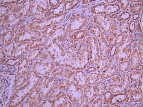 IHC image of CSB-RA169564A0HU diluted at 1:100 and staining in paraffin-embedded human kidney tissue performed on a Leica BondTM system. After dewaxing and hydration, antigen retrieval was mediated by high pressure in a citrate buffer (pH 6.0). Section was blocked with 10% normal goat serum 30min at RT. Then primary antibody (1% BSA) was incubated at 4°C overnight. The primary is detected by a Goat anti-rabbit polymer IgG labeled by HRP and visualized using 0.05% DAB.