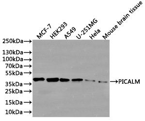 Western Blot
Positive WB detected in: MCF7 whole cell lysate(30µg), HEK293 whole cell lysate(30µg), A549 whole cell lysate(30µg), U251 whole cell lysate(30µg), Hela whole cell lysate(30µg), Mouse brain tissue lysate(30µg)
All lanes: p-Nucleophosmin (S125) antibody at 1:1000
Secondary
Goat polyclonal to rabbit IgG at 1/40000 dilution
Predicted band size: 33 kDa
Observed band size: 38 kDa
Exposure time：2min