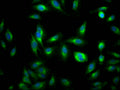 Immunofluorescence staining of Hela Cells with CSB-RA170650A0HU at 1:50, counter-stained with DAPI. The cells were fixed in 4% formaldehyde, permeated by 0.2% TritonX-100, and blocked in 10% normal Goat Serum. The cells were then incubated with the antibody overnight at 4℃. Nuclear DNA was labeled in blue with DAPI. The secondary antibody was FITC-conjugated AffiniPure Goat Anti-Rabbit IgG (H+L) .