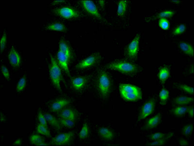 Immunofluorescence staining of Hela Cells with CSB-RA170650A0HU at 1:50, counter-stained with DAPI. The cells were fixed in 4% formaldehyde, permeated by 0.2% TritonX-100, and blocked in 10% normal Goat Serum. The cells were then incubated with the antibody overnight at 4℃. Nuclear DNA was labeled in blue with DAPI. The secondary antibody was FITC-conjugated AffiniPure Goat Anti-Rabbit IgG (H+L) .