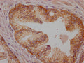BRAF Antibody – Figure 1 of 2
