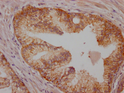 BRAF Antibody – Figure 1 of 2