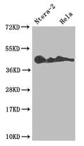 Western Blot
Positive WB detected in: Ntera-2 whole cell lysate, Hela whole cell lysate
All lanes: LEFTY2 antibody at 1:1000
Secondary
Goat polyclonal to rabbit IgG at 1/50000 dilution
Predicted band size: 41, 38 kDa
Observed band size: 36-45 kDa