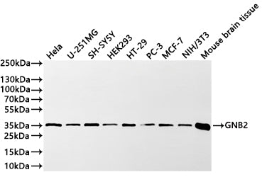 Western Blot
Positive WB detected in: Hela whole cell lysate(30µg) ,U-251MG whole cell lysate(30µg) , SH-SY5Y whole cell lysate(30µg) , HEK293 whole cell lysate(30µg) ,HT-29 whole cell lysate(30µg) ,PC-3 whole cell lysate(30µg) ,MCF-7 whole cell lysate(30µg) ,NIH/3T3 whole cell lysate(30µg) ,Mouse brain tissue lysate(20µg) 
All lanes: GNB2 antibody at 1:1000
Secondary
Goat polyclonal to rabbit IgG at 1/40000 dilution
Predicted band size: 37 kDa
Observed band size: 35 kDa
Exposure time：1min