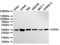 Western Blot
Positive WB detected in: K562 whole cell lysate(30µg) , Jurkat whole cell lysate(30µg) , Raji whole cell lysate(30µg) , HEK293 whole cell lysate(30µg) , MCF-7 whole cell lysate(30µg) , NTERA-2 whole cell lysate(30µg) 
All lanes: CDK1 antibody at 1:1000
Secondary
Goat polyclonal to rabbit IgG at 1/40000 dilution
Predicted band size: 34 kDa
Observed band size: 34 kDa
Exposure time：2min