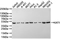Western Blot
Positive WB detected in: Jurkat whole cell lysate(30µg) , HEK293 whole cell lysate(30µg) , A-431 whole cell lysate(30µg) , MCF-7 whole cell lysate(30µg) , HeLa whole cell lysate(30µg) , PC-3 whole cell lysate(30µg) , HepG2 whole cell lysate(30µg) , NIH/3T3 whole cell lysate(30µg) , THP-1 whole cell lysate(30µg) 
All lanes: KAT1 antibody at 1:1000
Secondary
Goat polyclonal to rabbit IgG at 1/50000 dilution
Predicted band size: 50 kDa
Observed band size: 50 kDa
Exposure time: 3min